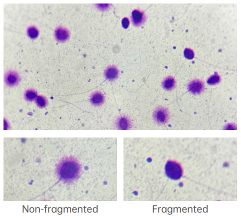 Sperm DNA Fragmentation (SCD Method)